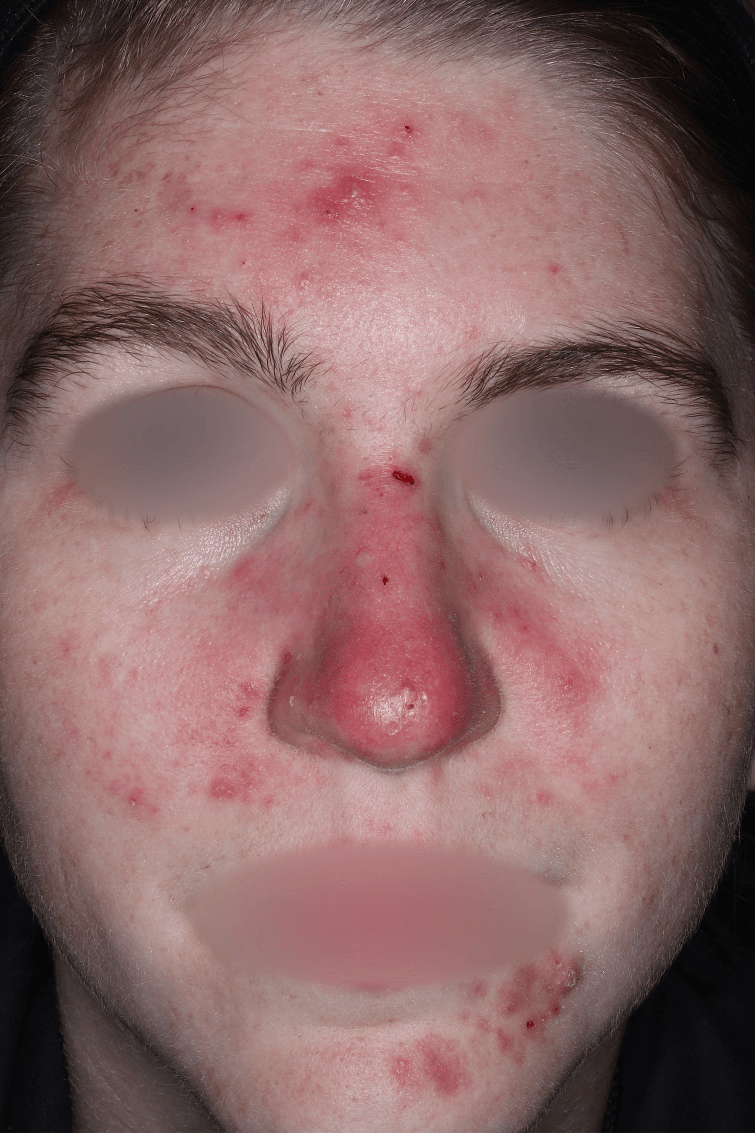 Patient C Before